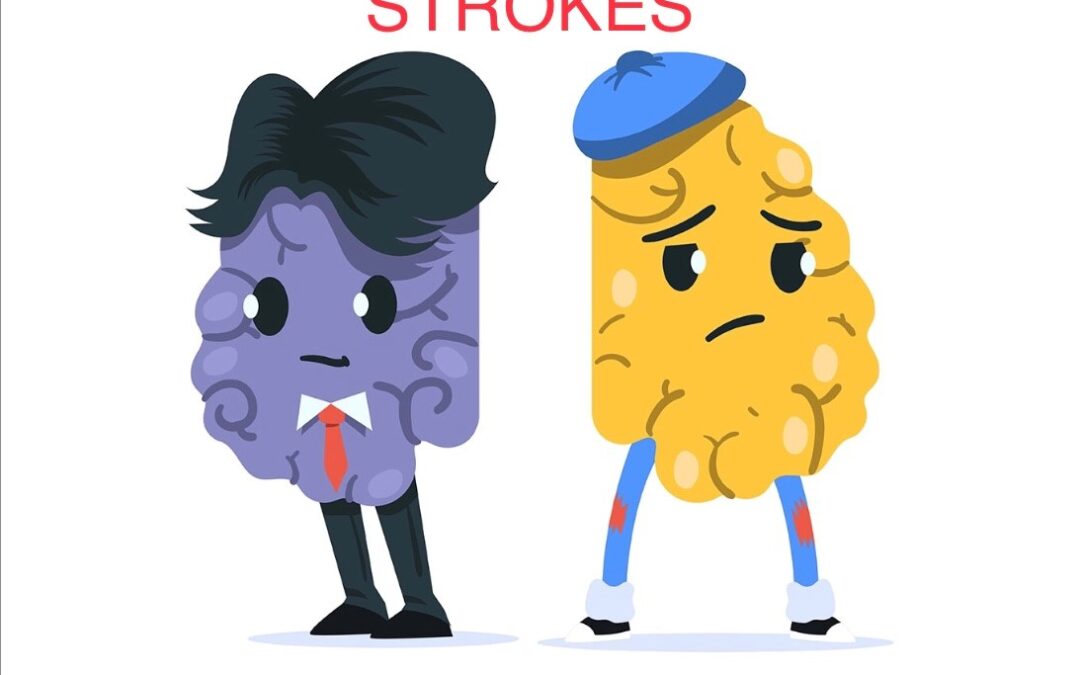 STROKES